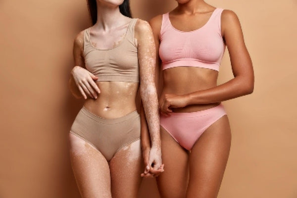 Alteraciones de la pigmentación en la piel